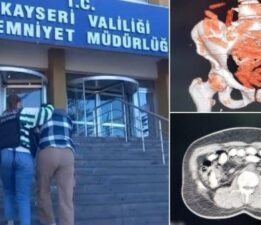 Midesinden yaklaşık 1 kilo uyuşturucu çıktı