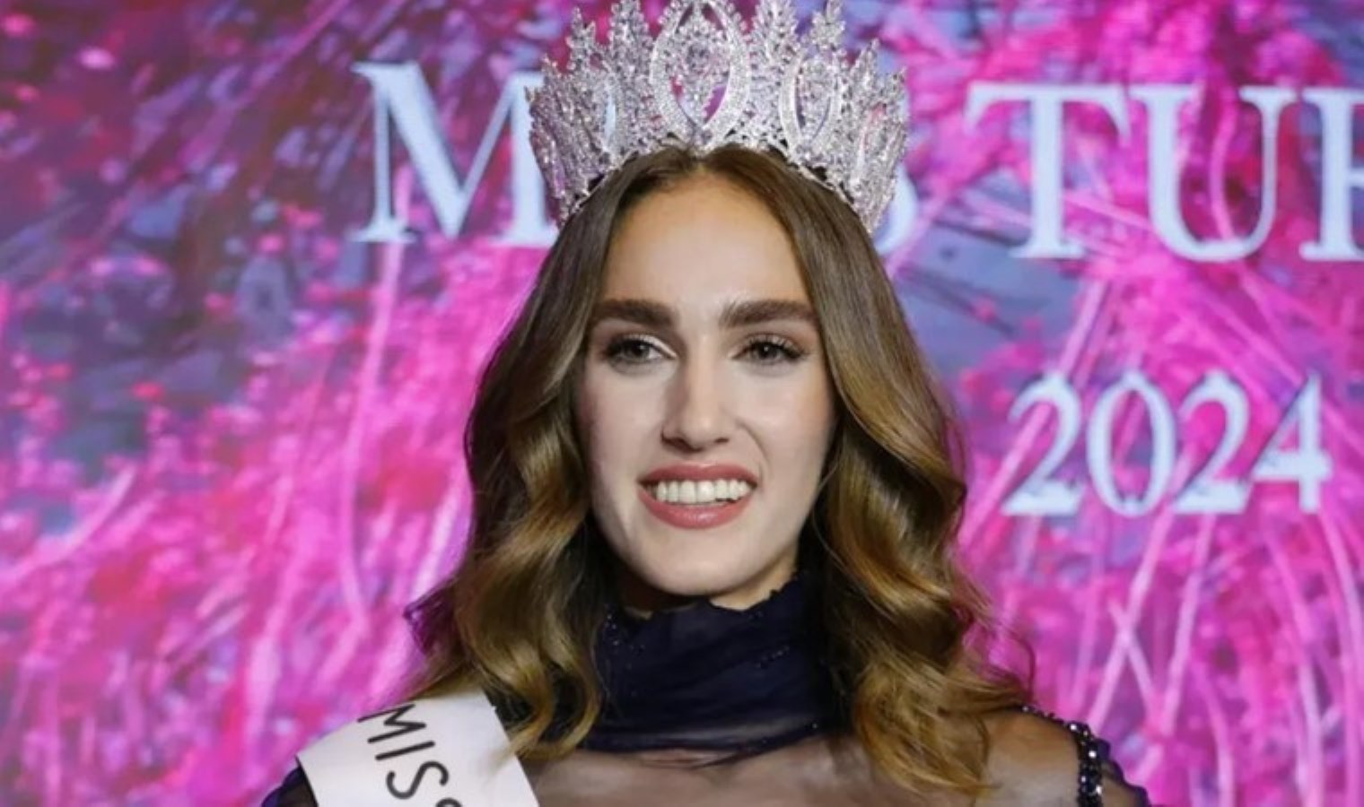 Miss Turkey güzeli İdil Bilgen’in son hali çok tartışıldı: Estetik mi yaptırdı?